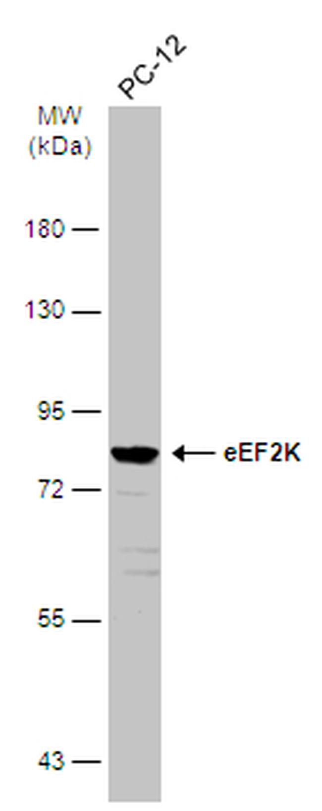 EEF2K Antibody in Western Blot (WB)