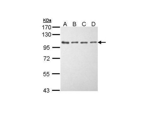 EEF2K Antibody in Western Blot (WB)