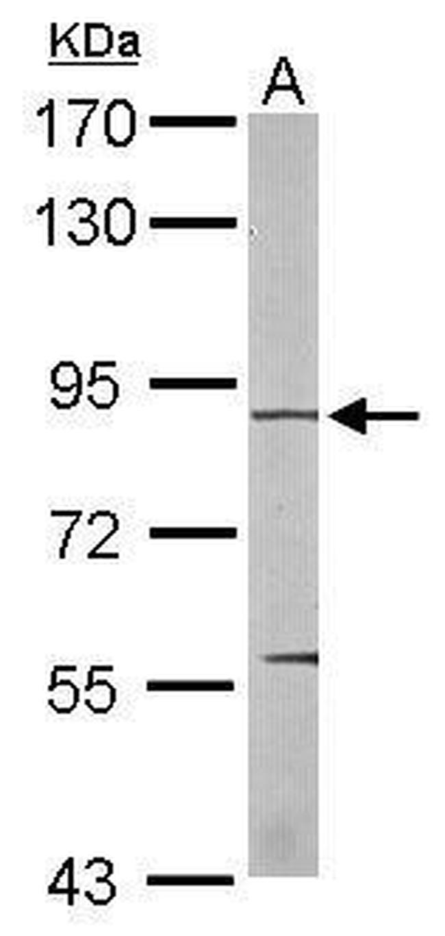 EEF2K Antibody in Western Blot (WB)