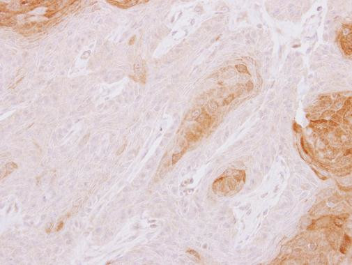 TXNDC3 Antibody in Immunohistochemistry (Paraffin) (IHC (P))