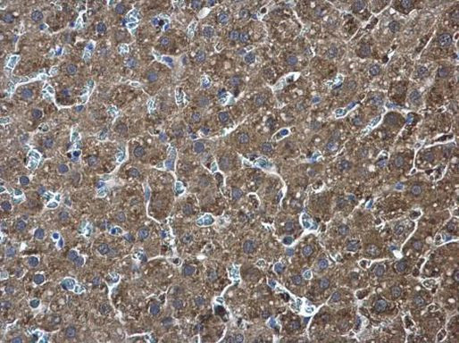 PKLR Antibody in Immunohistochemistry (Paraffin) (IHC (P))