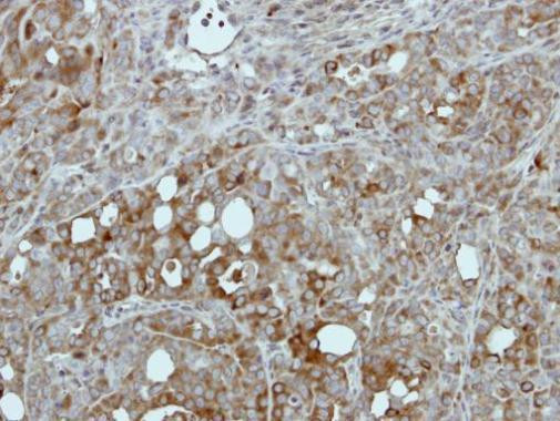 PKLR Antibody in Immunohistochemistry (Paraffin) (IHC (P))