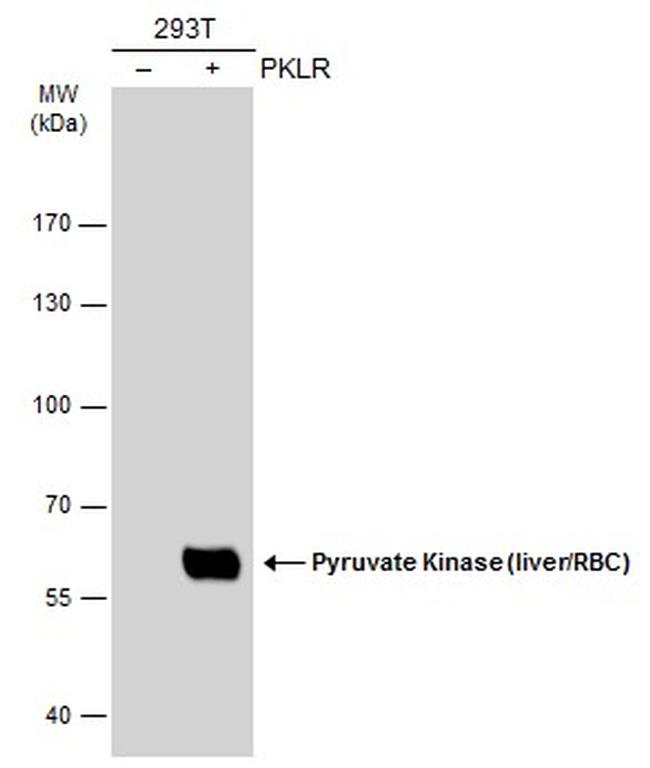 PKLR Antibody in Western Blot (WB)