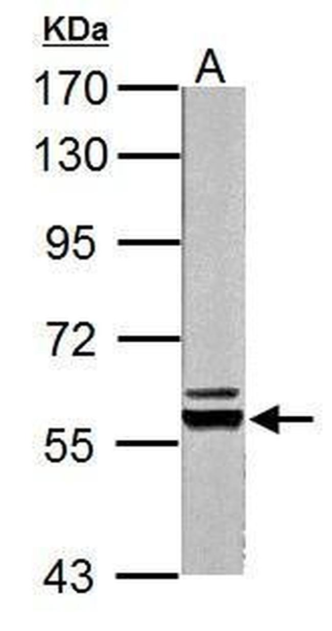 PKLR Antibody in Western Blot (WB)