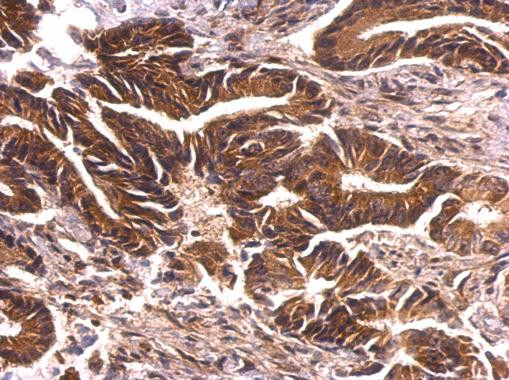 PKN2 Antibody in Immunohistochemistry (Paraffin) (IHC (P))