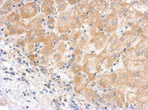 Complement C5 Antibody in Immunohistochemistry (Paraffin) (IHC (P))