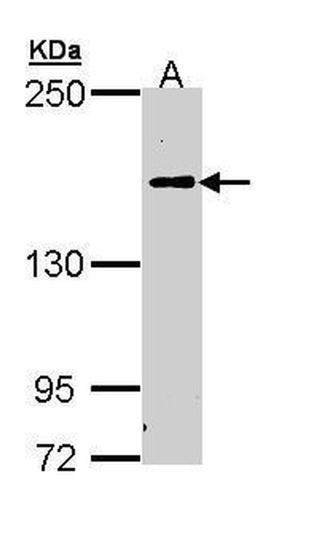 Complement C5 Antibody in Western Blot (WB)