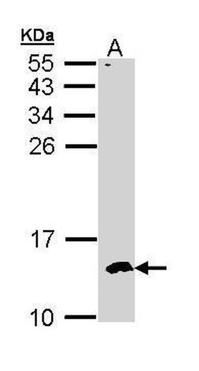 CKS2 Antibody in Western Blot (WB)