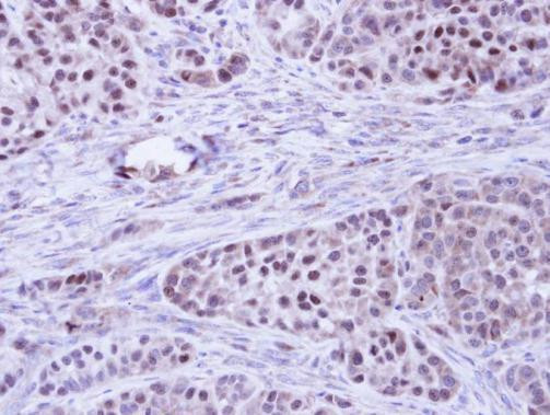 Bcl-B Antibody in Immunohistochemistry (Paraffin) (IHC (P))