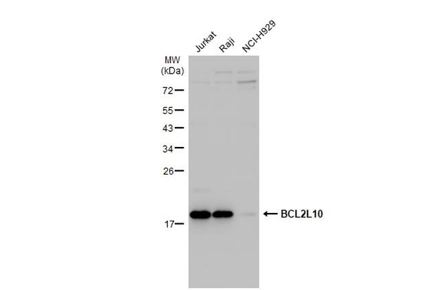 Bcl-B Antibody in Western Blot (WB)