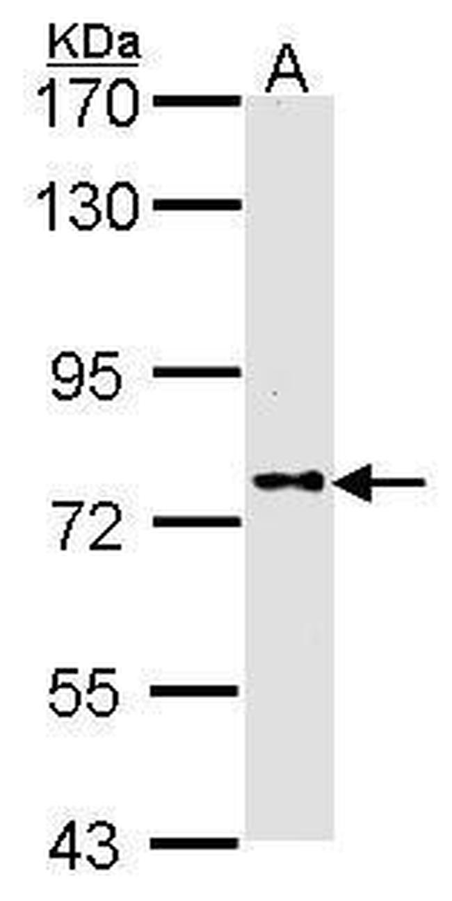 DPP8 Antibody in Western Blot (WB)