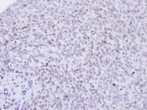 PCNP Antibody in Immunohistochemistry (Paraffin) (IHC (P))