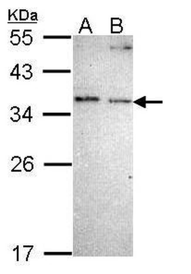 NOSIP Antibody in Western Blot (WB)