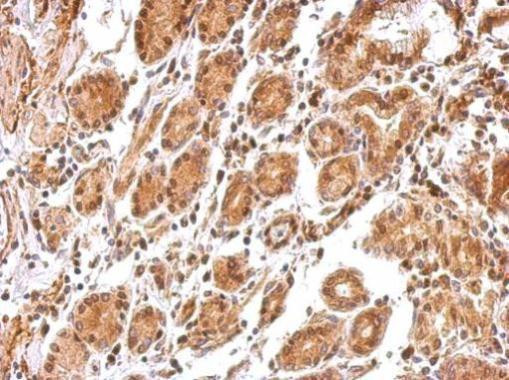 BCL2L12 Antibody in Immunohistochemistry (Paraffin) (IHC (P))