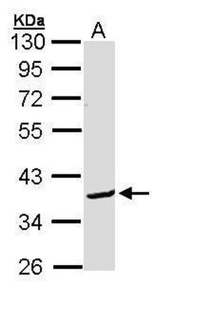 BCL2L12 Antibody in Western Blot (WB)