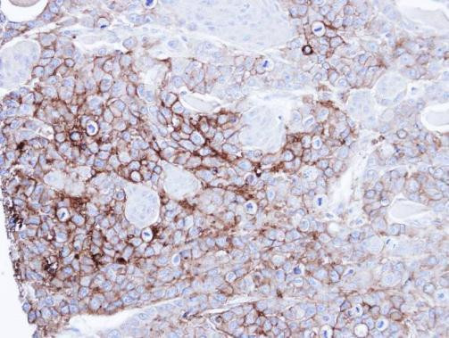 Intestinal Alkaline Phosphatase Antibody in Immunohistochemistry (Paraffin) (IHC (P))