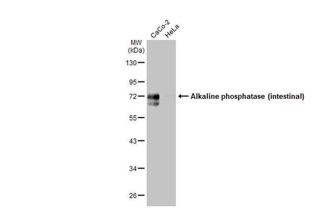 Intestinal Alkaline Phosphatase Antibody in Western Blot (WB)