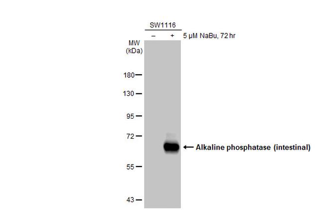 Intestinal Alkaline Phosphatase Antibody in Western Blot (WB)