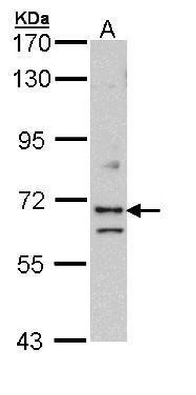 EXOC7 Antibody in Western Blot (WB)