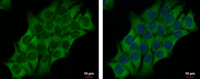 AdoHcyase 3 Antibody in Immunocytochemistry (ICC/IF)