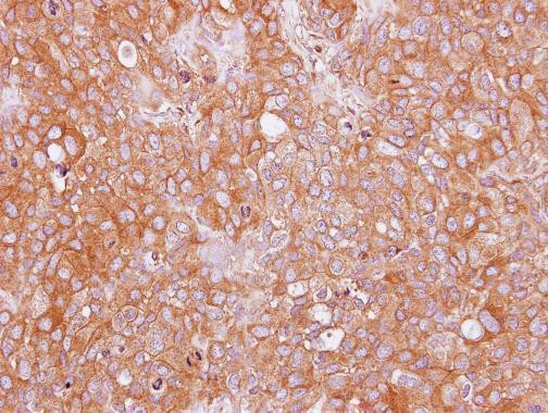 AdoHcyase 3 Antibody in Immunohistochemistry (Paraffin) (IHC (P))