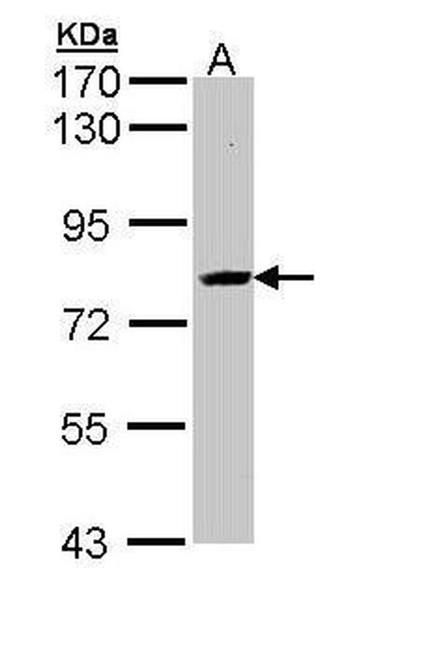 AdoHcyase 3 Antibody in Western Blot (WB)