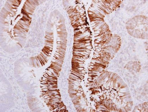 AdoHcyase 3 Antibody in Immunohistochemistry (Paraffin) (IHC (P))