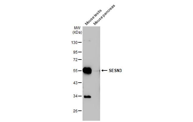 SESN3 Antibody in Western Blot (WB)