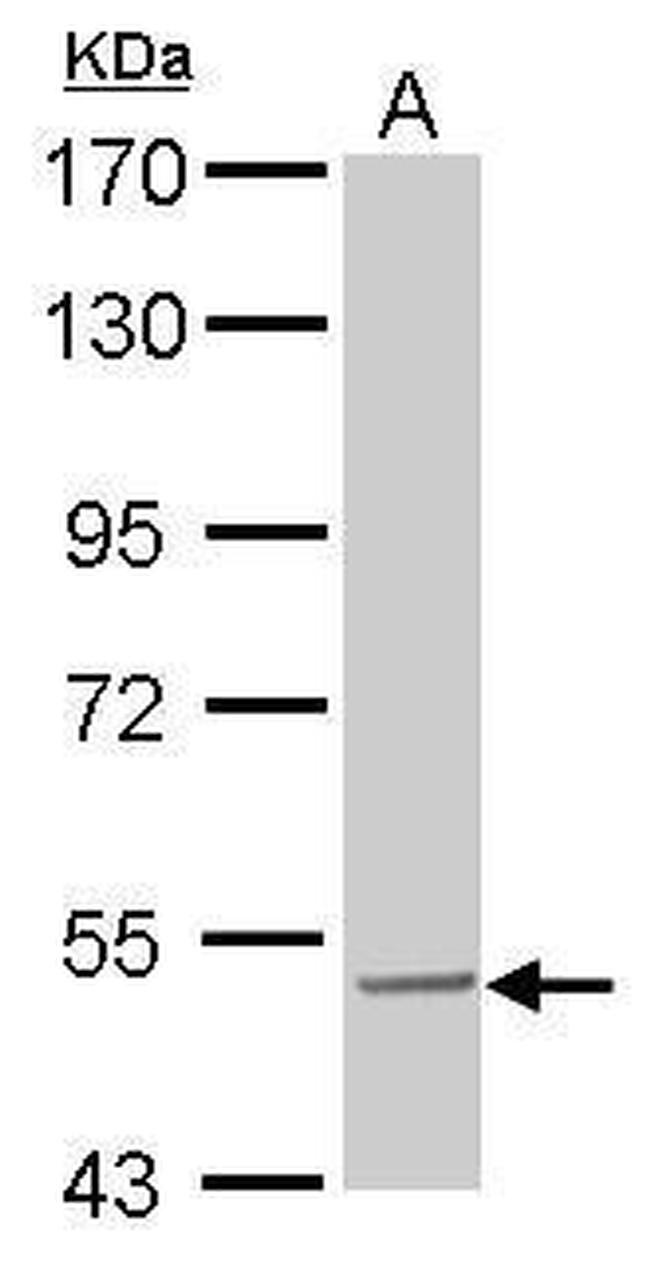 SESN3 Antibody in Western Blot (WB)