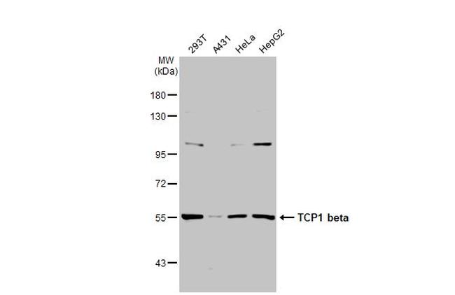 TCP-1 beta Antibody in Western Blot (WB)