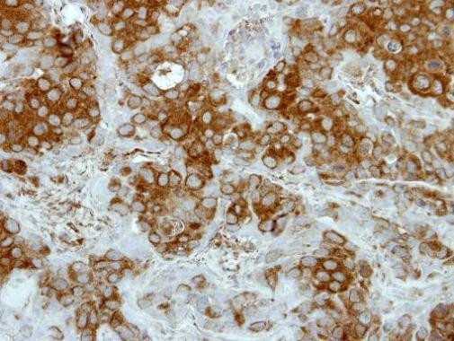 DTX1 Antibody in Immunohistochemistry (Paraffin) (IHC (P))