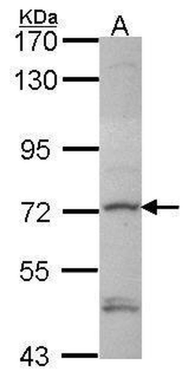 DTX1 Antibody in Western Blot (WB)