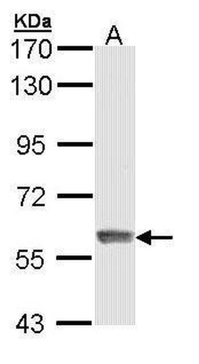 IFIT3 Antibody in Western Blot (WB)