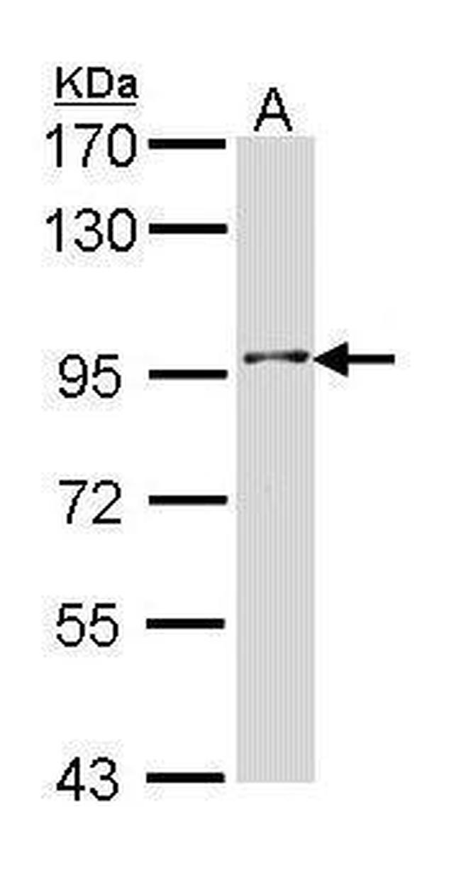 INPP5B Antibody in Western Blot (WB)