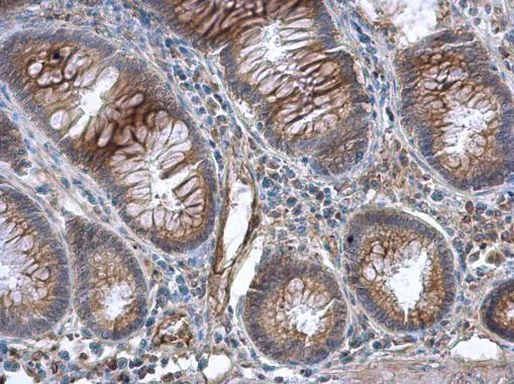 GBP3 Antibody in Immunohistochemistry (Paraffin) (IHC (P))