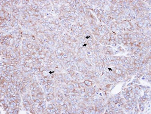 CAP1 Antibody in Immunohistochemistry (Paraffin) (IHC (P))