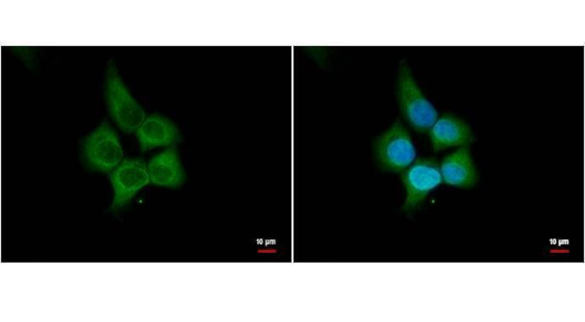 HHIP Antibody in Immunocytochemistry (ICC/IF)