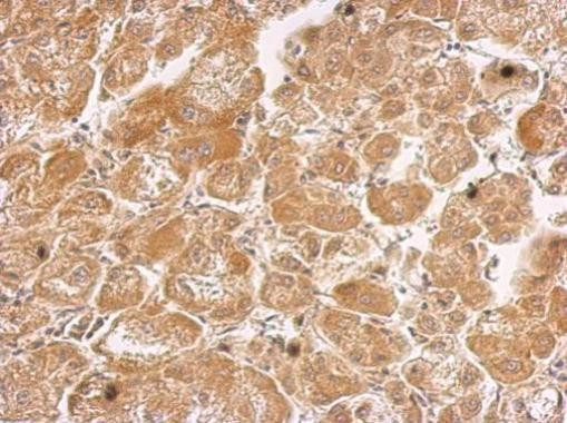 HHIP Antibody in Immunohistochemistry (Paraffin) (IHC (P))