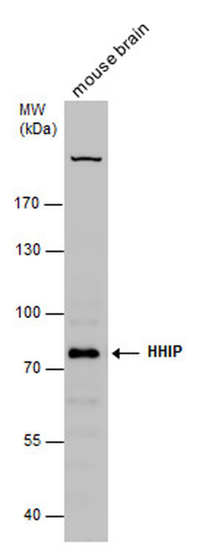 HHIP Antibody in Western Blot (WB)