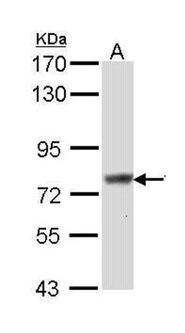 SCIN Antibody in Western Blot (WB)