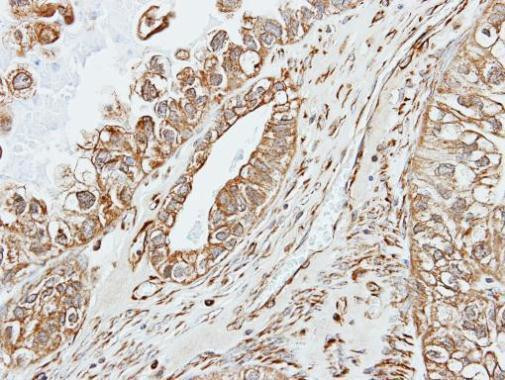 Pancreatic Amylase Antibody in Immunohistochemistry (Paraffin) (IHC (P))