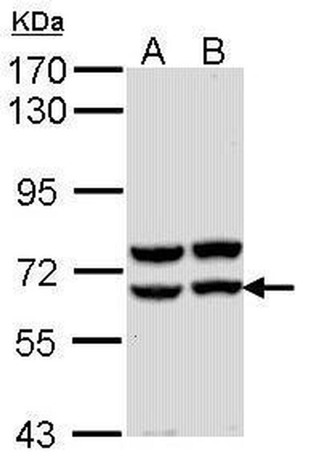 Pancreatic Amylase Antibody in Western Blot (WB)