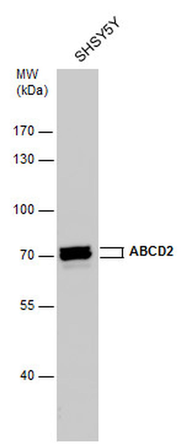 ABCD2 Antibody in Western Blot (WB)