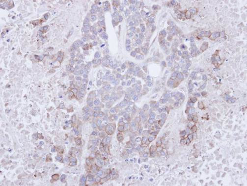 BTLA Antibody in Immunohistochemistry (Paraffin) (IHC (P))