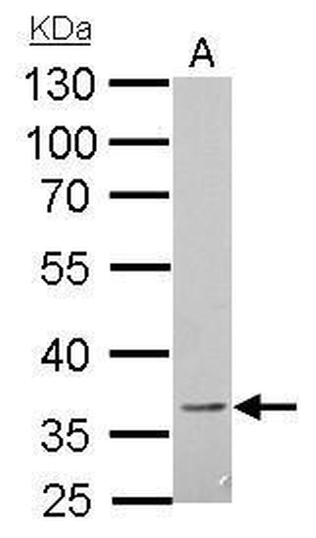 BTLA Antibody in Western Blot (WB)