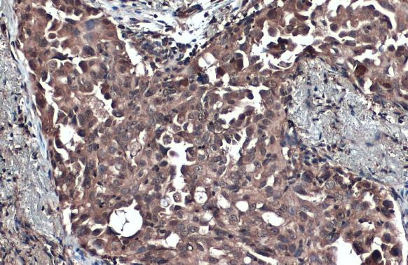 Caspase 9 Antibody in Immunohistochemistry (Paraffin) (IHC (P))