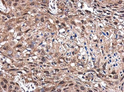 Caspase 9 Antibody in Immunohistochemistry (Paraffin) (IHC (P))