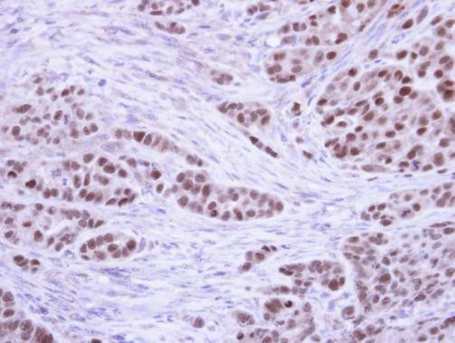 RPA2 Antibody in Immunohistochemistry (Paraffin) (IHC (P))