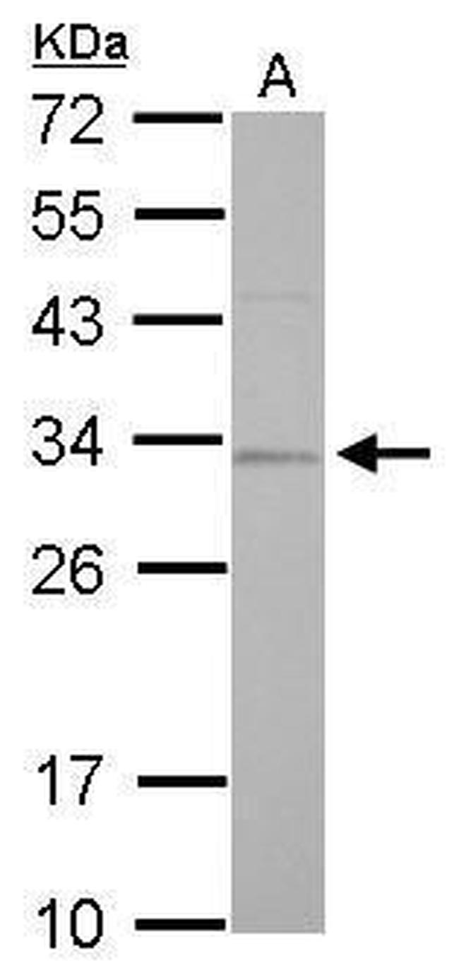 RPA2 Antibody in Western Blot (WB)