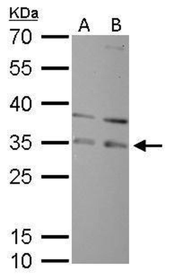 RPA2 Antibody in Western Blot (WB)